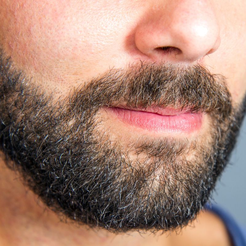 brada i brkovi pet meseci